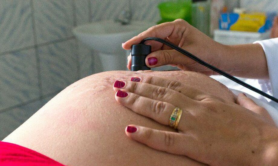 Novos exames a gestantes são ofertados pela rede pública de saúde.