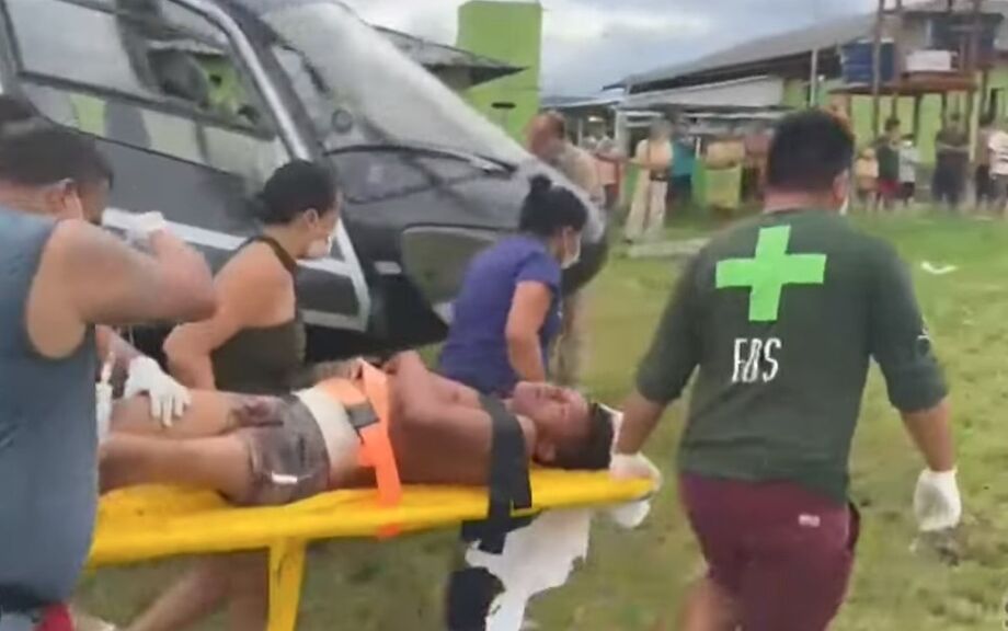 Ataque também matou agente de saúde e feriu outro indígena
