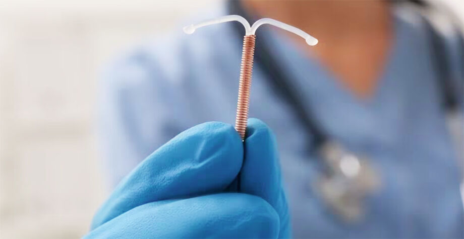 Dispositivo intrauterino (DIU) pode ser inserido gratuitamente em mais de 25 unidades básicas de saúde em Campo Grande
