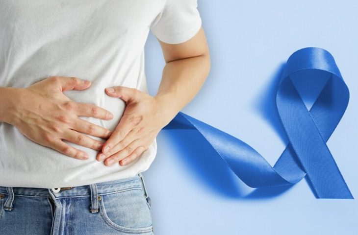 O câncer de intestino é conhecido como câncer colorretal porque engloba os tumores surgidos na parte do intestino grosso chamada cólon e reto