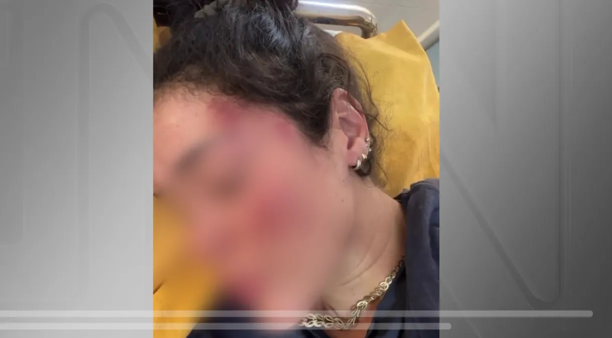 Em um vídeo postado nas redes sociais, o casal, que aparece com hematomas nos rostos, ainda afirmou que foi roubado pelo grupo