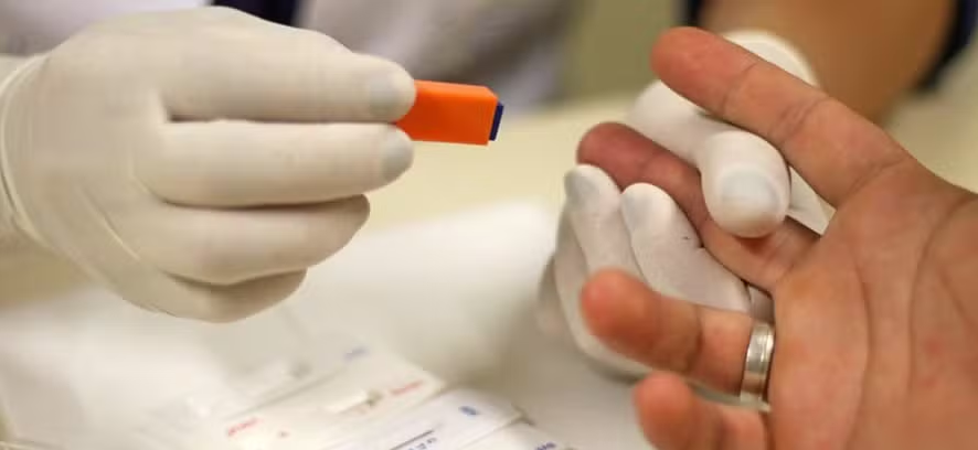 Farmácias poderão realizar testes rápidos de HIV e sífilis