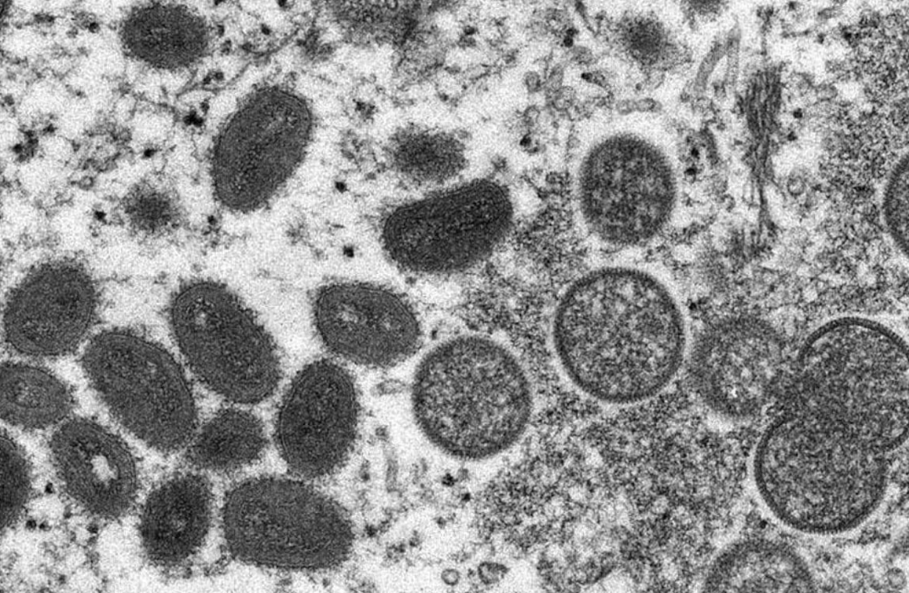 Imagem de microscópio eletrônico mostra sinais da varíola dos macacos em uma amostra de pele humana