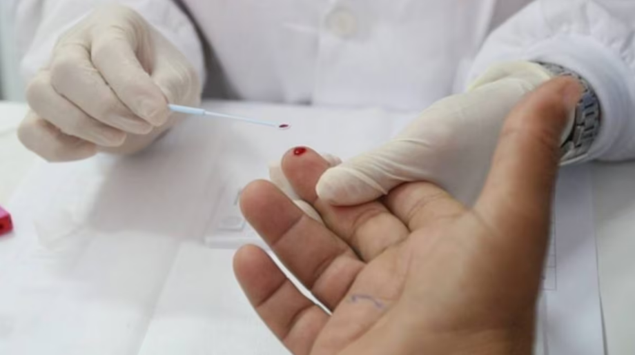 Pesquisadores identificaram pacientes com nova variante em três Estados brasileiros