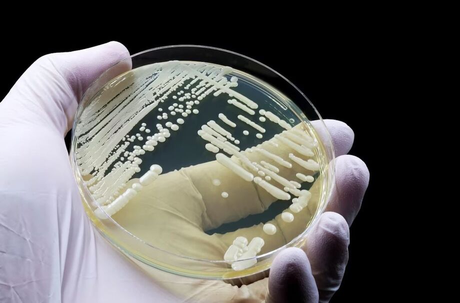 Candida auris é resistente às medicações usadas para combater fungos do mesmo gênero
