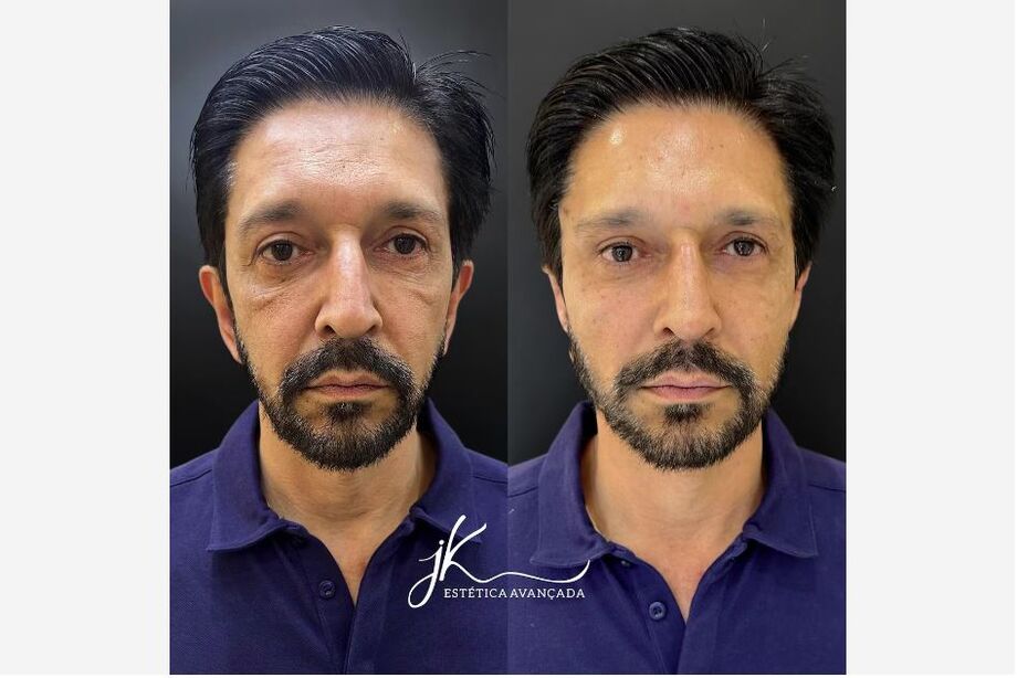 Ricardo Nunes faz procedimento facial em clínica na zona sul de São Paulo