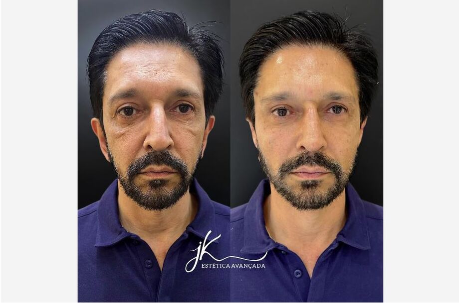 Ricardo Nunes faz procedimento facial em clínica na zona sul de São Paulo