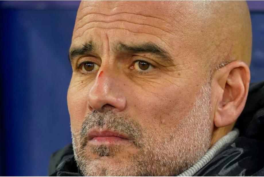 Pequeno corte no nariz de Pep Guardiola chamou a atenção.