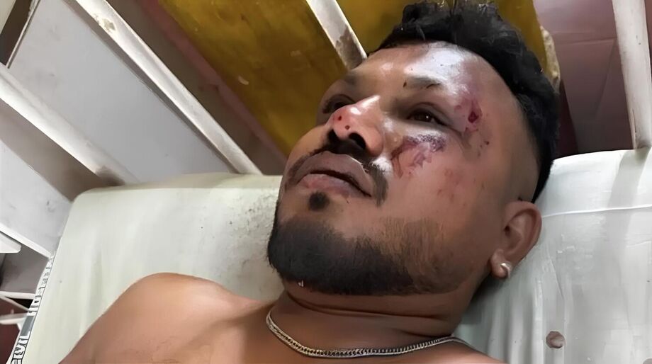 Passageiro sobrevive à queda de avião e diz que problemas começaram 30 segundos após voo