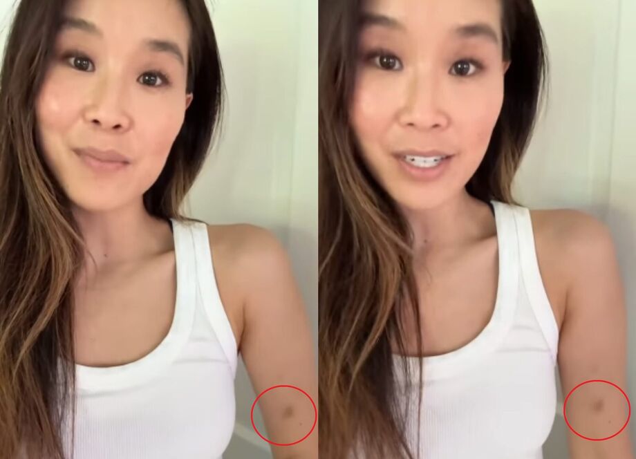 Alicia Hannah-Kim ficou com hematoma no braço após ser mordida pelo ator Martin Kove