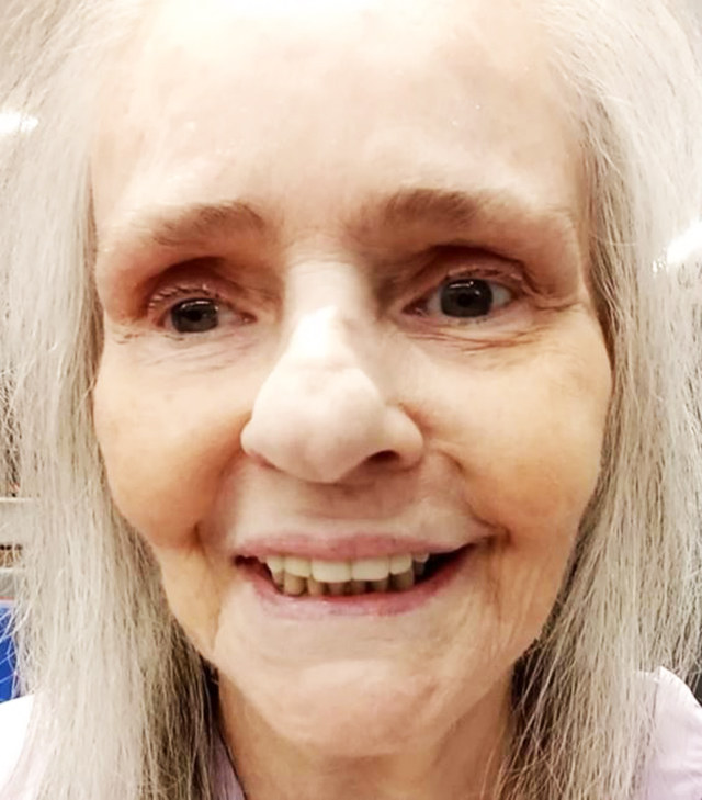 Angela Ro Ro está internada desde junho e recebe apoio de fãs para custear tratamento
