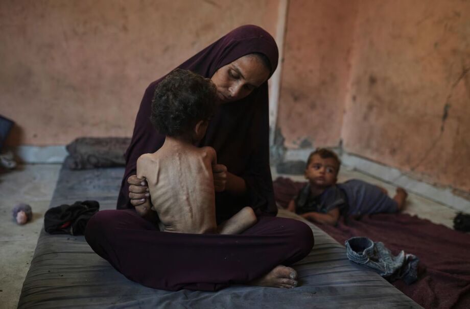 Naima Abu Ful segura seu filho desnutrido de 2 anos, Yazan, em sua casa no campo de refugiados de Shati, na Cidade de Gaza