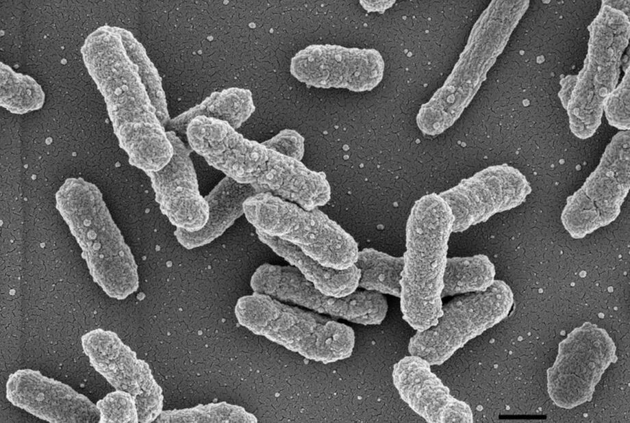 Colônia de bactérias Yersina pestis. (Foto: Muhsin Özel, Gudrun Holland, Rolf Reissbrodt/RKI)