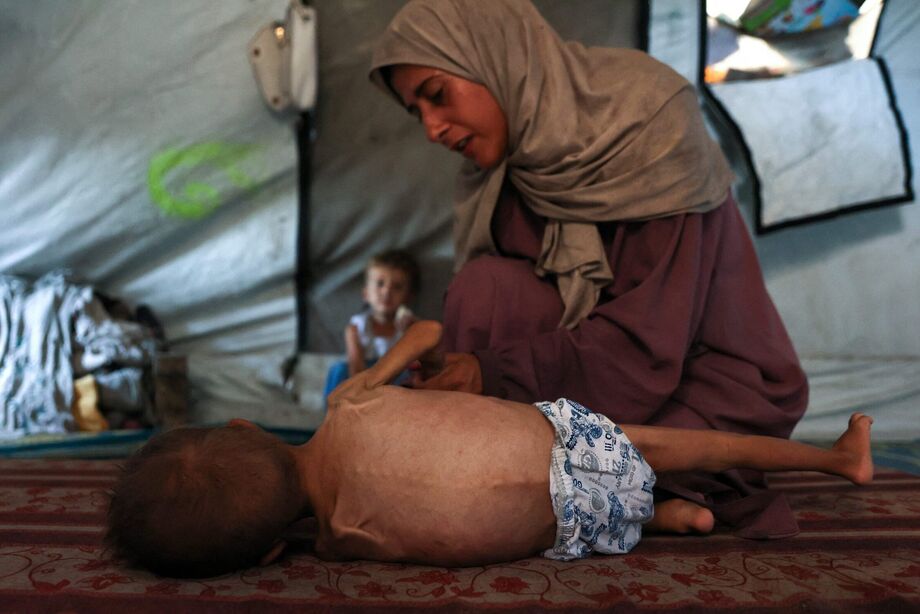 Imagem desta terça-feira, 24, mostra Hidaya, mãe palestina de 24 anos, ao lado do seu filho, Mohammed al-Mutawaq, de 1 ano e 6 meses, em uma barraca para refugiados na Faixa de Gaza. Bebê tem sinais de desnutrição e está doente