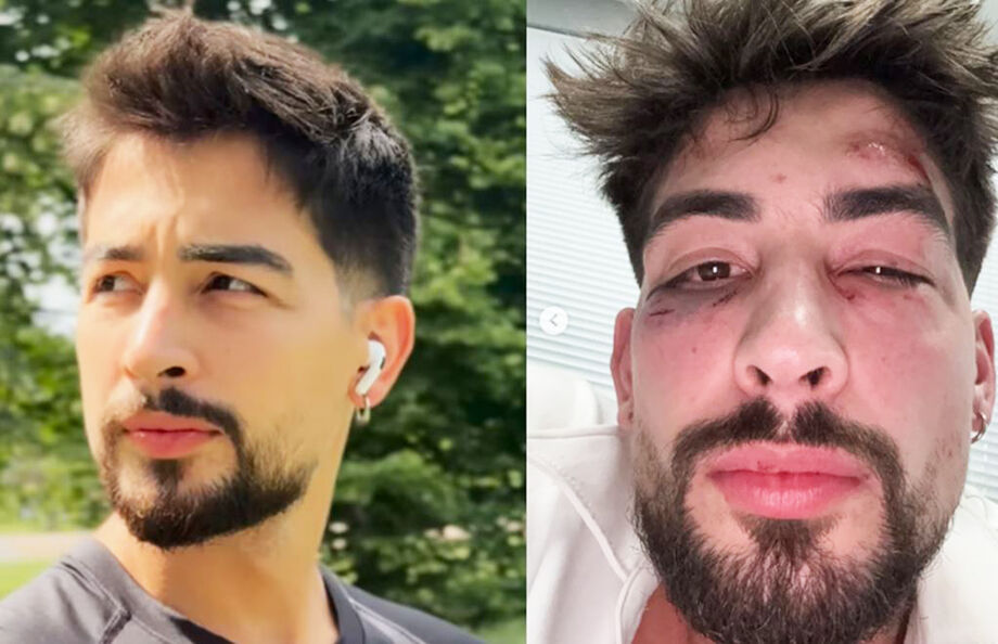 O empresário Donizete Oliveira, de 29 anos, denunciou ter sido vítima de agressão dentro de um karaokê, localizado na Santa Cecília, região central de São Paulo, na madrugada do último domingo, 17.