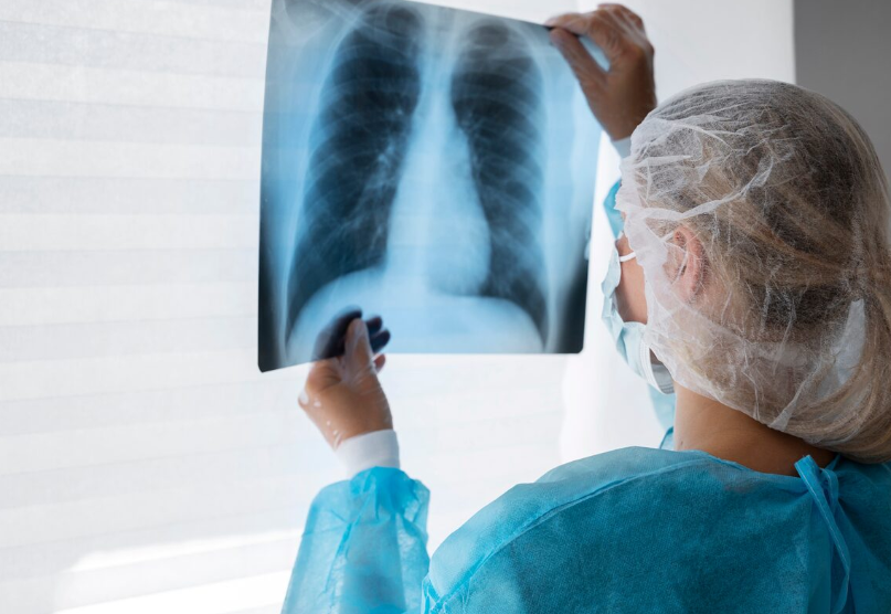 Nódulos suspeitos no pulmão podem ser diagnosticados com tomografia do tórax
