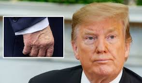 O presidente dos Estados Unidos, Donald Trump, chamou atenção nesta sexta-feira (22) ao aparecer com uma camada grossa de maquiagem na mão direita.
