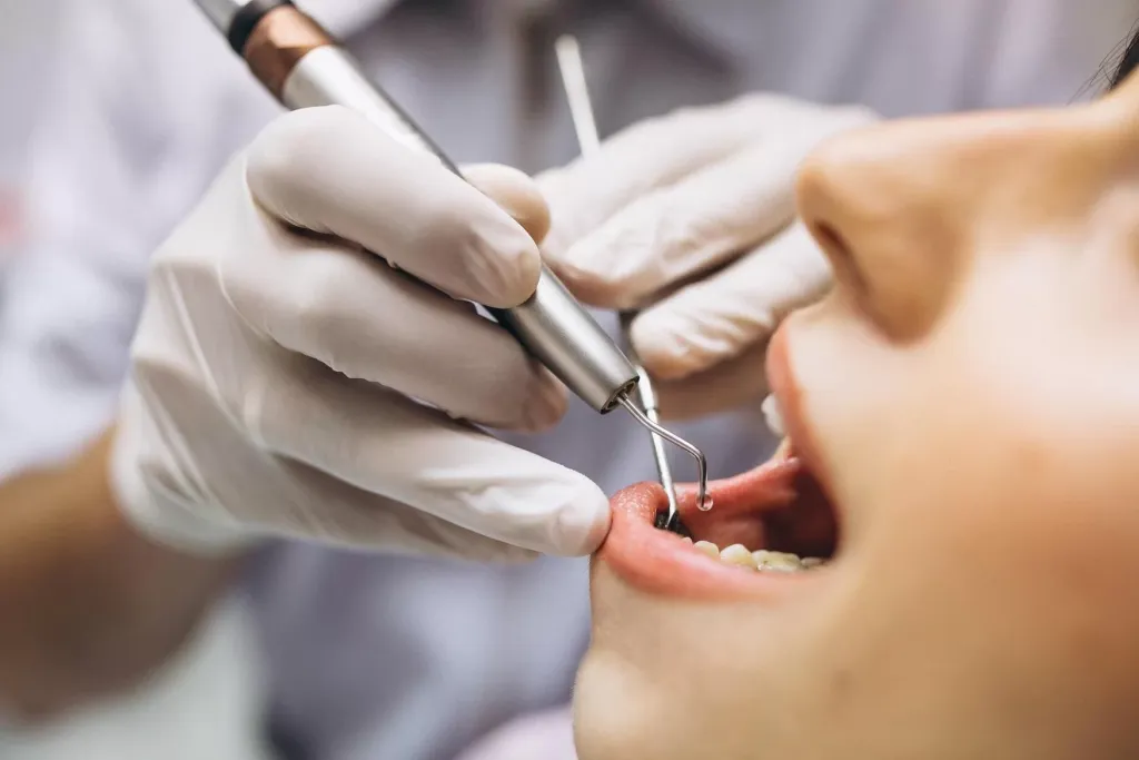 A ABO-MS abrirá vagas para um procedimento inovador de implantes dentários, com resultados em até 10 dias