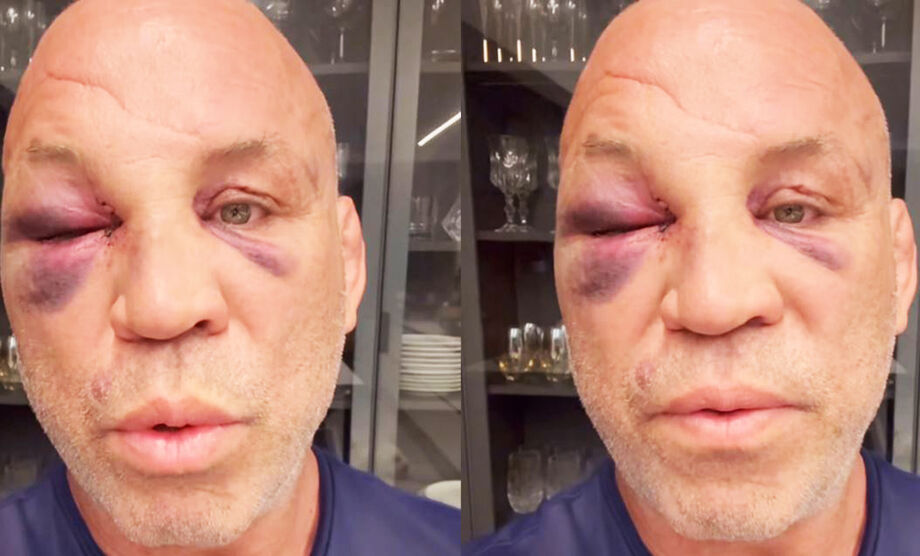 Wanderlei Silva desabafou nas redes sociais após sofrer lesões em confusão no Spaten Fight Night 2