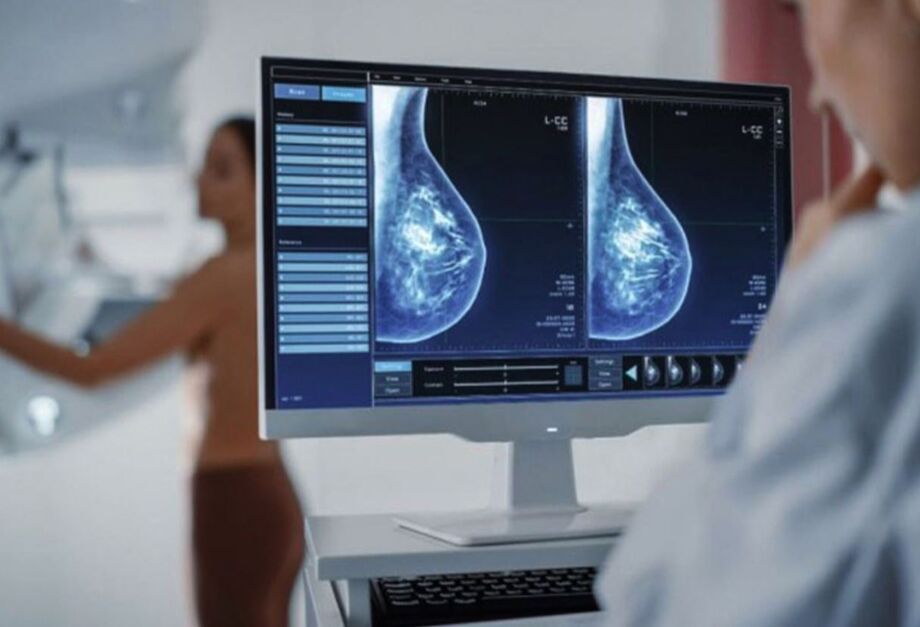 Antes indicada até os 69 anos, a mamografia passará a ser oferecida no SUS a quem tem até 74 anos