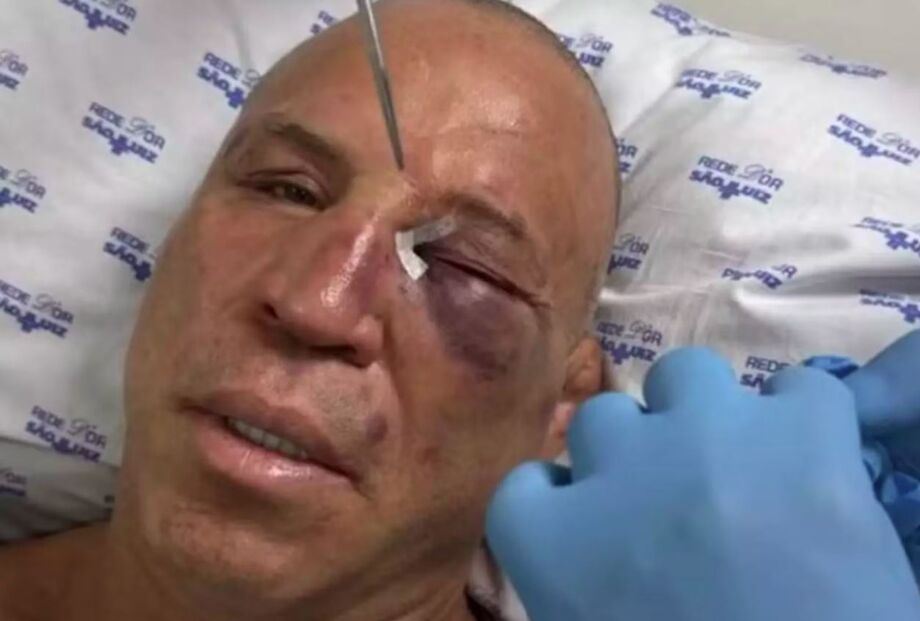 Wanderlei Silva sofre fratura no nariz após agressão de filho de Popó e é levado ao hospital
