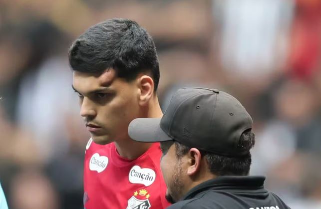 Gabriel Brazão se machuca em dividida em Atlético-MG x Santos.