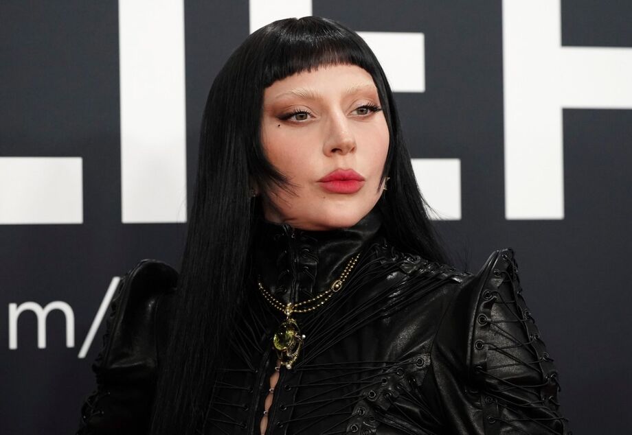 Lady Gaga cancela show nessa quarta-feira, 3, por problemas de saúde