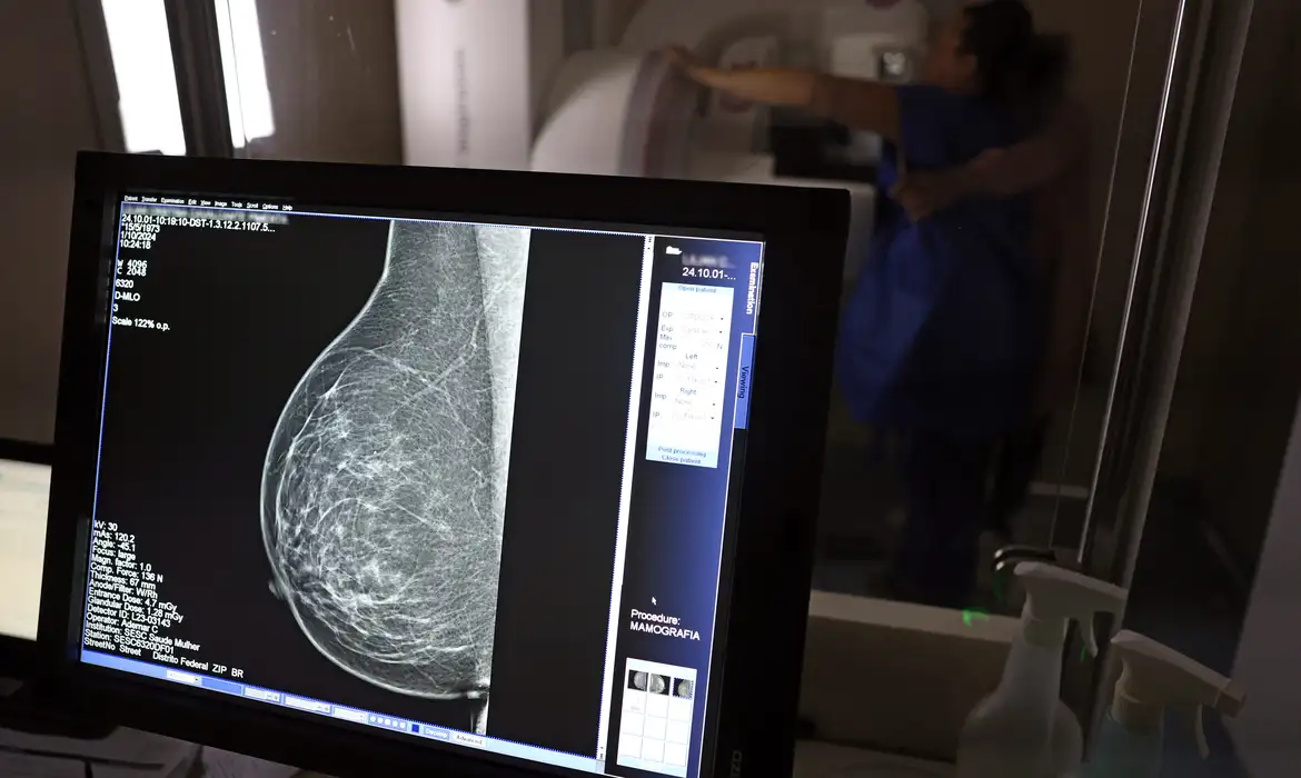 Pacientes com câncer de mama têm direito a benefícios do INSS, saque do FGTS e isenção de imposto de renda; legislação garante início do tratamento em até 60 dias após o diagnóstico.