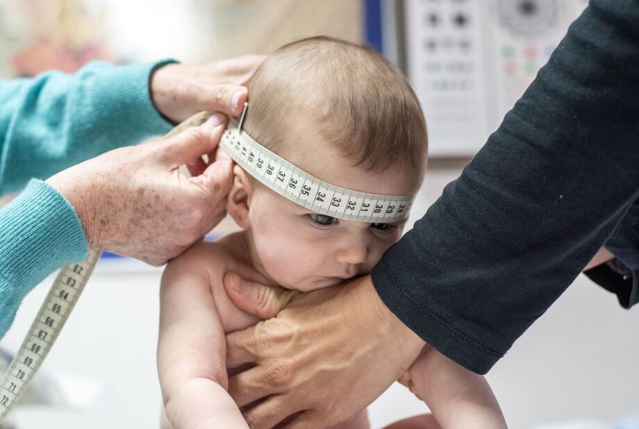 Pesquisa brasileira associa o aumento no perímetro cefálico nos primeiros meses do bebê ao QI na vida adulta