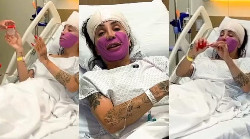 Transformação de Maya Massafera chamou atenção e reacendeu debate sobre cirurgias estéticas