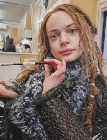 Ruth Codd explica sobre segunda amputação em vídeo nas redes sociais