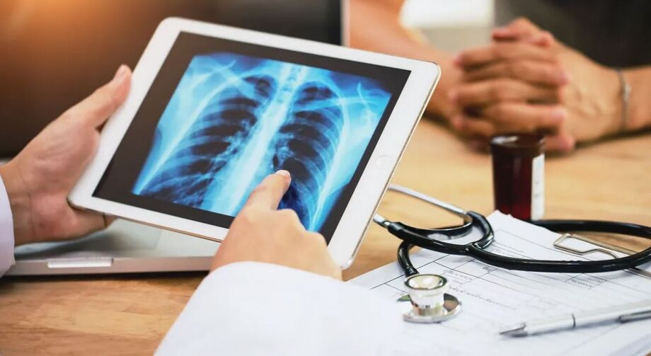 Casos graves de doenças respiratórias avançam em São Paulo, com influenza A e covid-19 entre os principais responsáveis pelas internações.