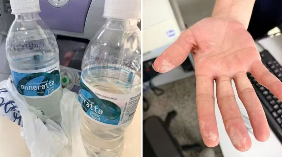 Garrafas de água contaminadas foram apreendidas na UPA de Garça após paciente relatar sintomas e ser hospitalizado