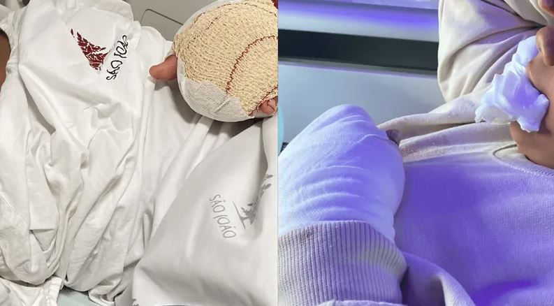 Portugal abre investigação oficial após menino brasileiro ter dedos mutilados em escola.