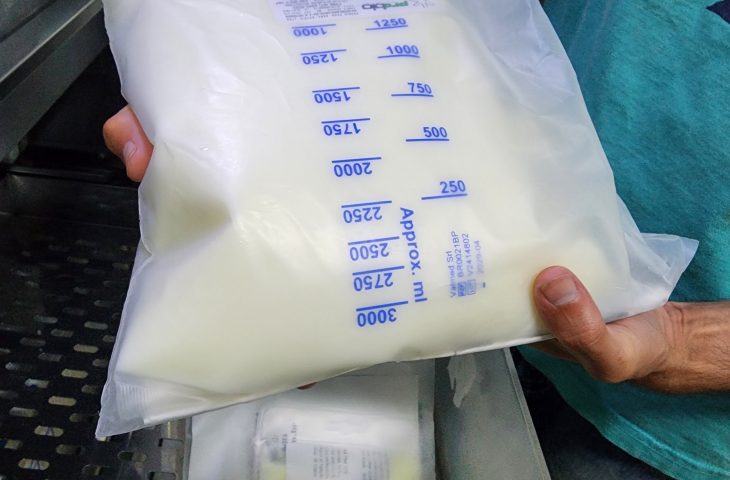 Hospital Regional reduz custo com nutrição parenteral e economiza mais de R$ 1,6 milhão por ano.