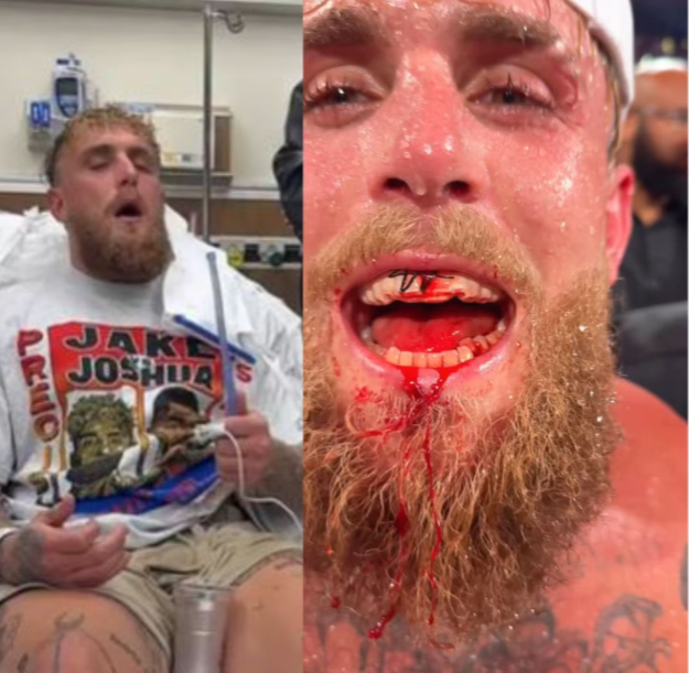 Jake Paul sofre duas fraturas na mandíbula