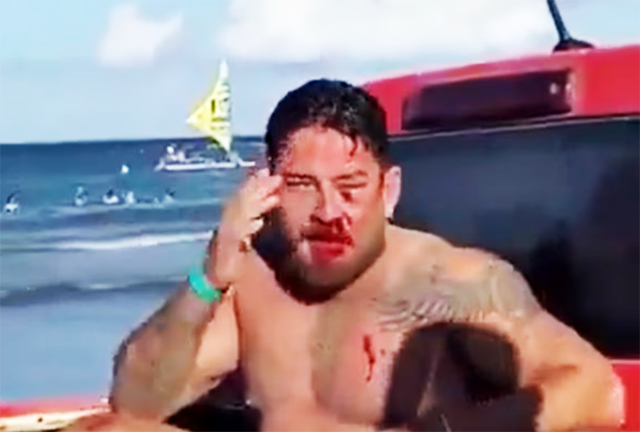 Casal de empresários é espancado em Porto de Galinhas após aluguel de cadeira