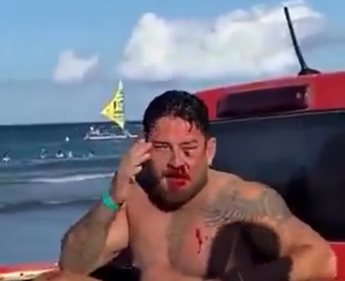 Casal de empresários é espancado em Porto de Galinhas após aluguel de cadeira