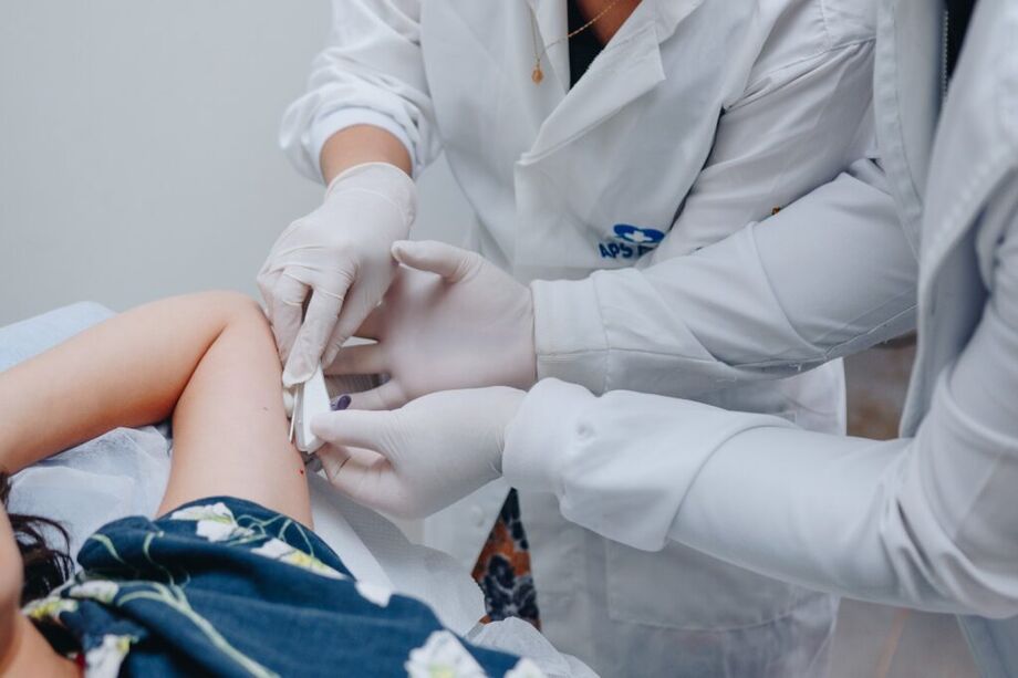 Campo Grande começa a ofertar o implante subdérmico Implanon no SUS para mulheres de 18 a 49 anos.