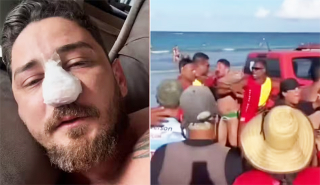 Agredido em Porto de Galinhas passa por cirurgia em MT