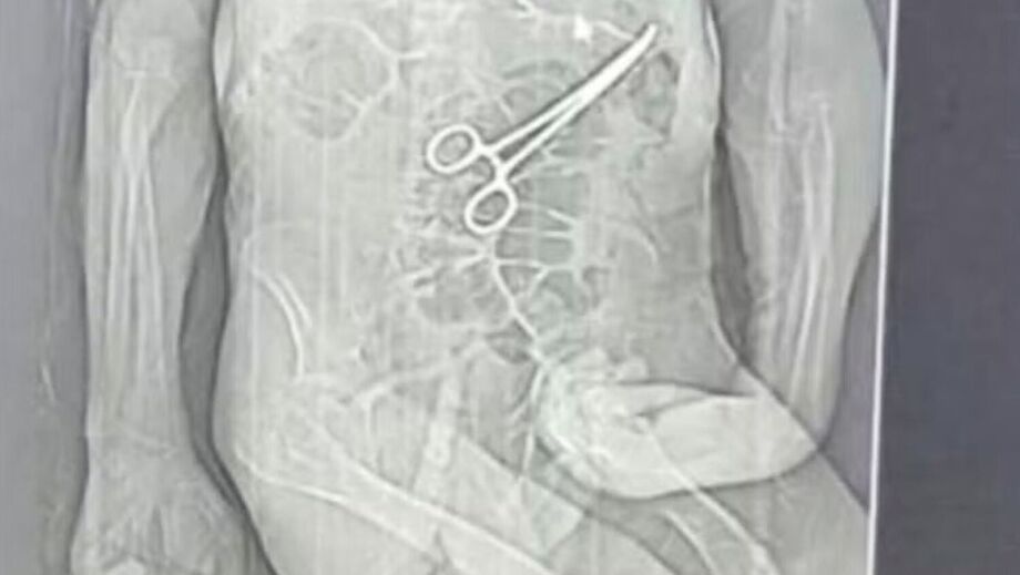 Idoso morre na véspera do Natal e família denuncia pinça esquecida dentro do corpo durante cirurgia em MG