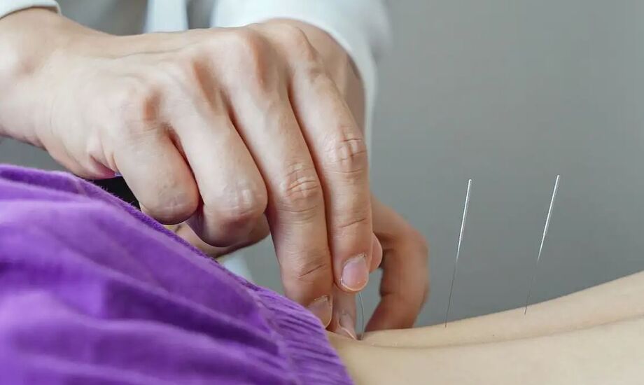 Lei regulamenta o exercício profissional da acupuntura no Brasil.