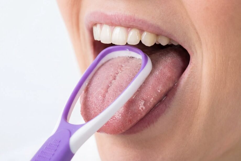Acúmulo de resíduos e bactérias na língua pode causar saburra lingual e mau hálito; higienização diária é essencial