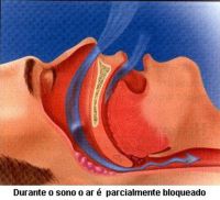 Serviço - Para conferir o tratamento do Ronco, a clínica Odontoart oferece o mais sofisticado métido
