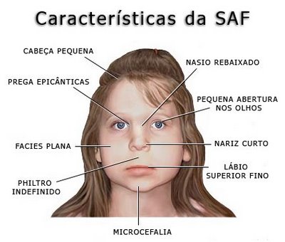 Mãe que bebe álcool pode gerar problemas para o bebê