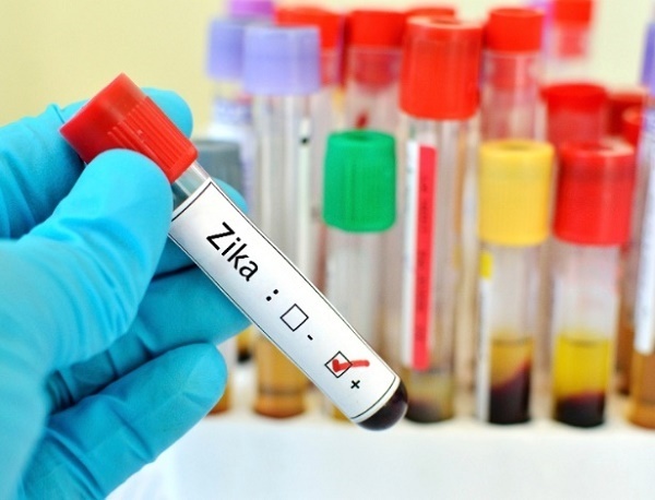 Público-alvo da vacina contra o zika vírus será mulheres em idade fértil