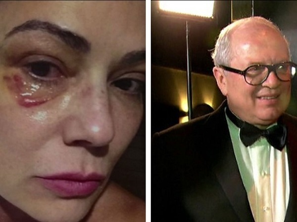 Luiza Brunet falou ao Ministério Público (MP) que foi agredida mais de uma vez por Lírio Parisotto