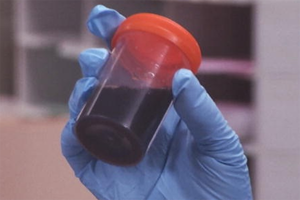 Uma das suspeitas é que doença seja causada pelo consumo de peixe; amostras foram enviadas para laboratório em SP e também nos EUA