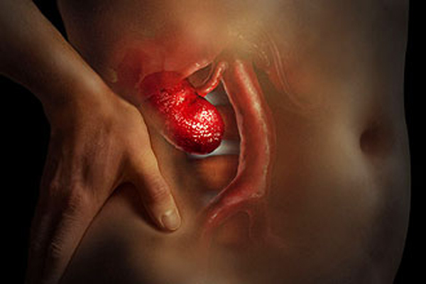 O número preocupa porque o excesso de gordura no corpo está relacionado a uma maior propensão a uma série de problemas, entre eles a Doença Renal Crônica