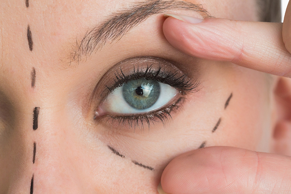 Estudos indicam que a genética é um importante fator quando existe a formação de bolsas abaixo dos olhos